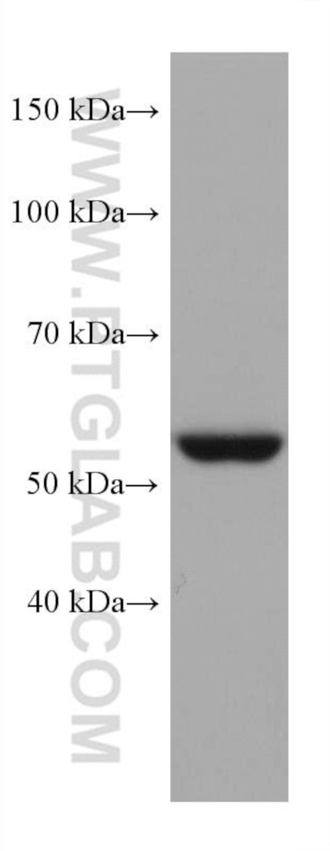 STK11 Antibody in Western Blot (WB)