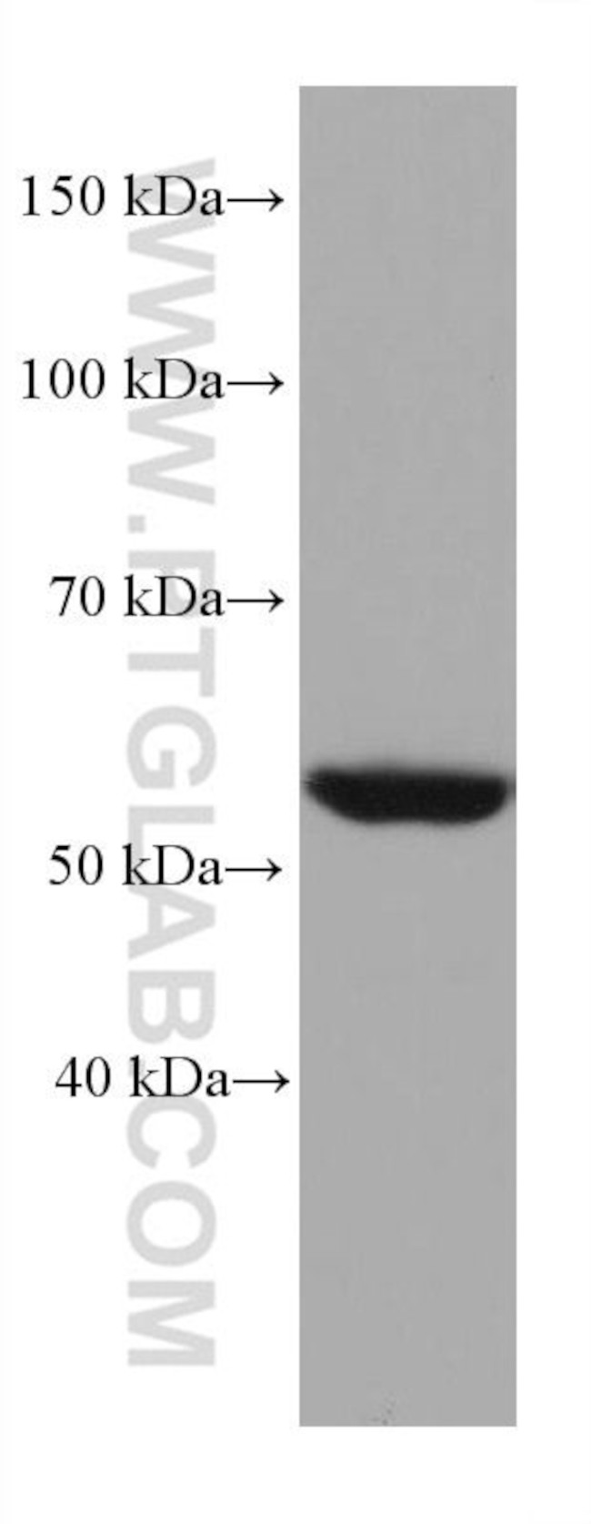 STK11 Antibody in Western Blot (WB)