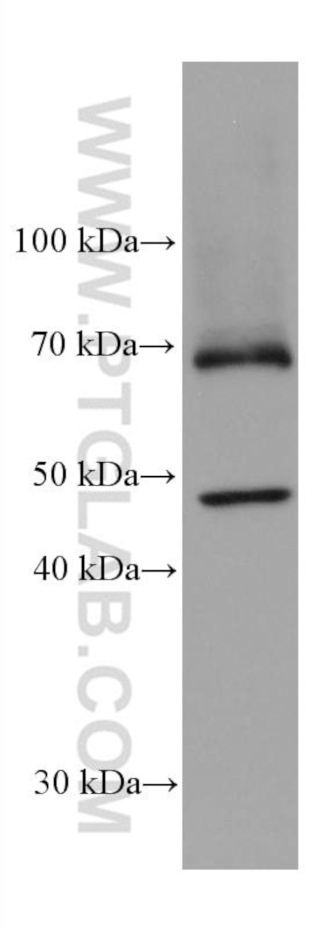 ACOX1 Antibody in Western Blot (WB)