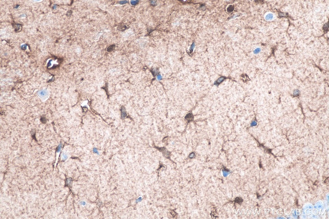 ALDH1L1 Antibody in Immunohistochemistry (Paraffin) (IHC (P))