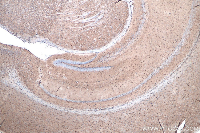 ALDH1L1 Antibody in Immunohistochemistry (Paraffin) (IHC (P))