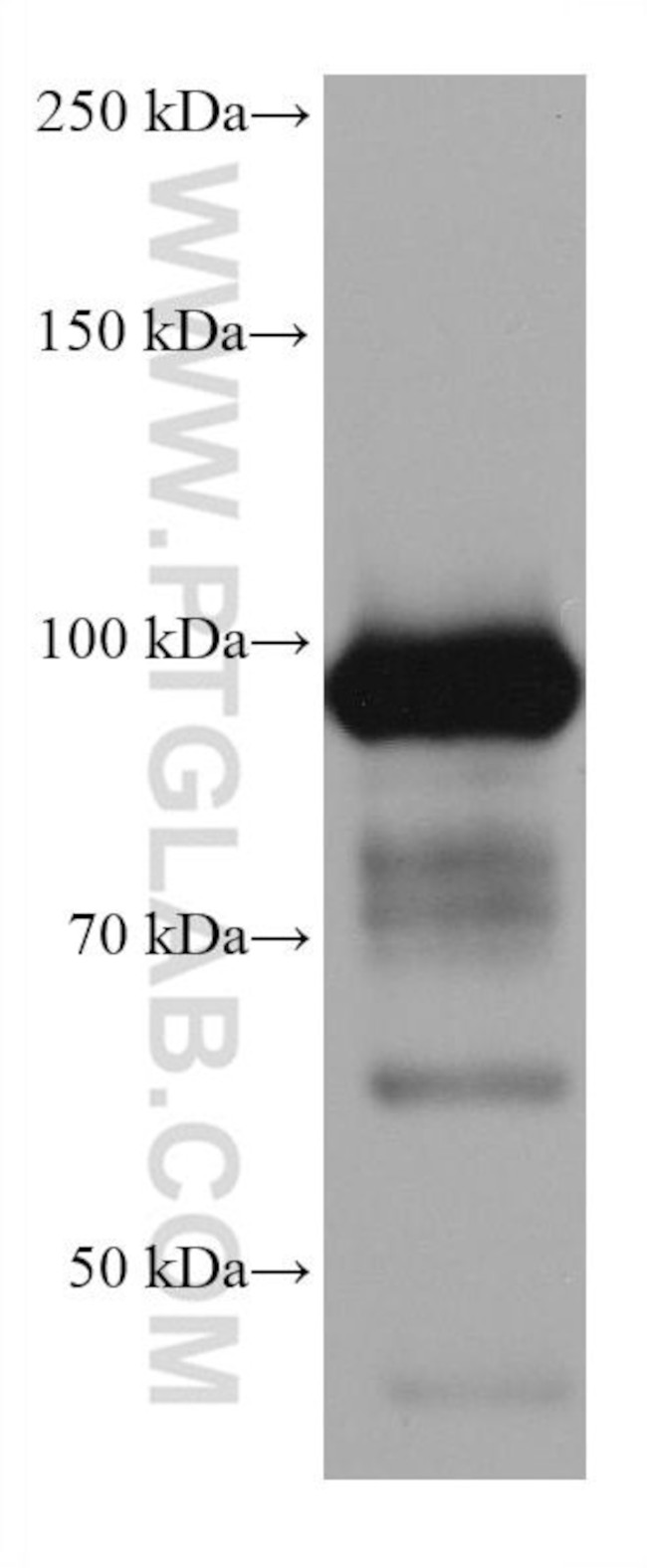 ALDH1L1 Antibody in Western Blot (WB)