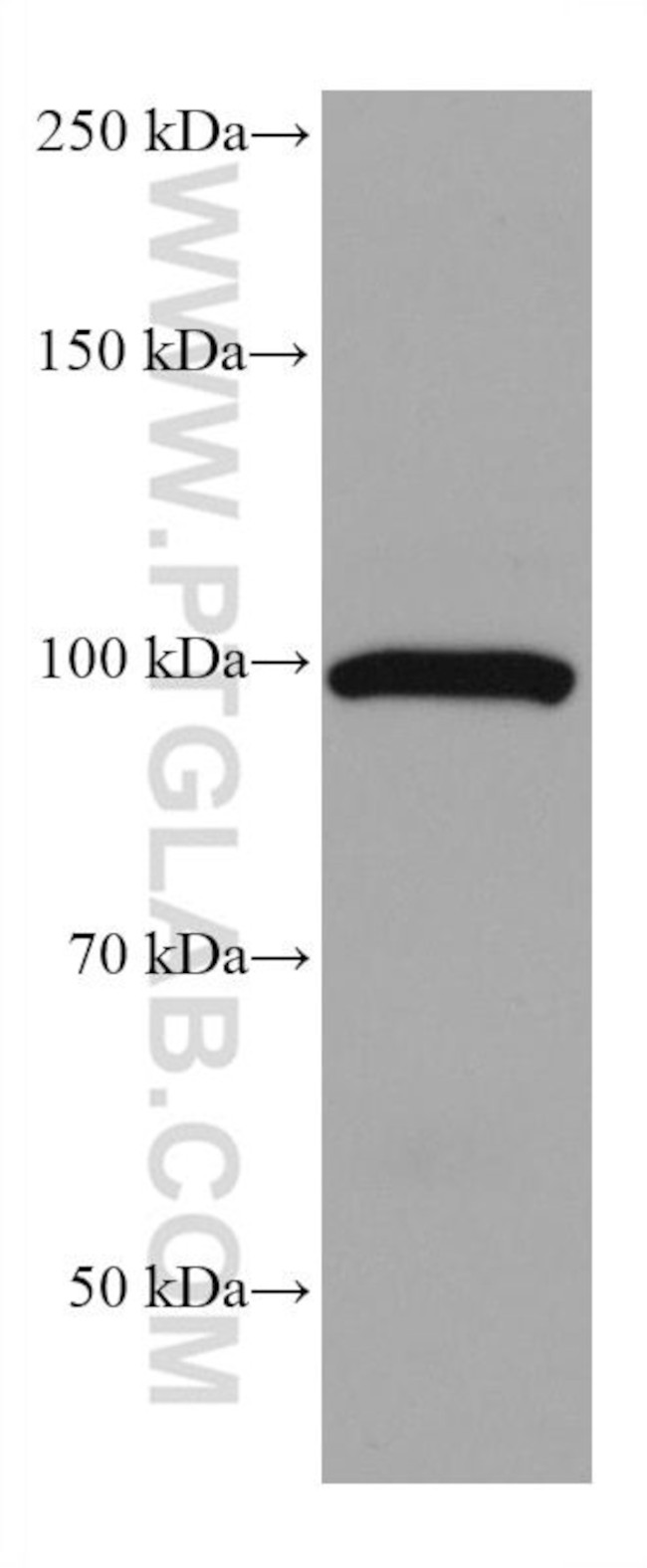 ALDH1L1 Antibody in Western Blot (WB)