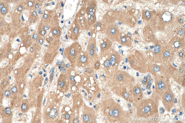 AGT Antibody in Immunohistochemistry (Paraffin) (IHC (P))