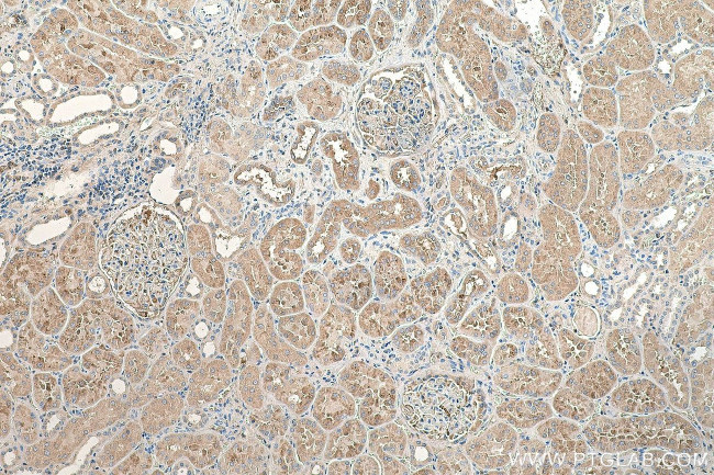 AGT Antibody in Immunohistochemistry (Paraffin) (IHC (P))