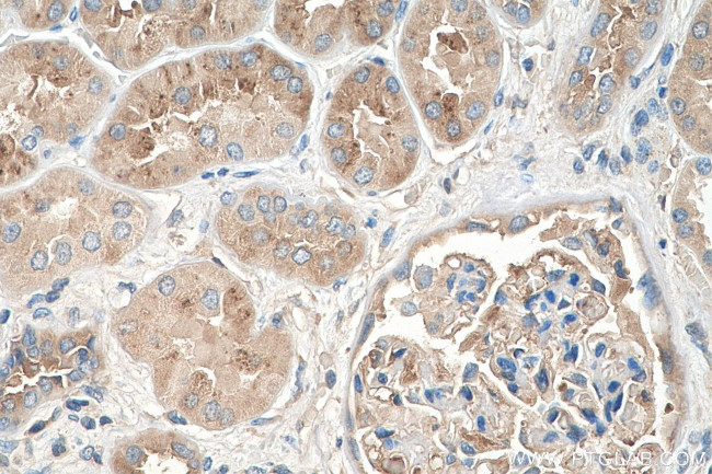 AGT Antibody in Immunohistochemistry (Paraffin) (IHC (P))