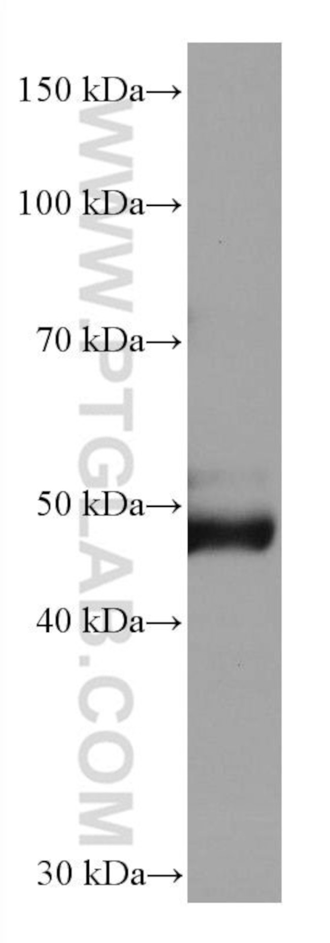 AGT Antibody in Western Blot (WB)