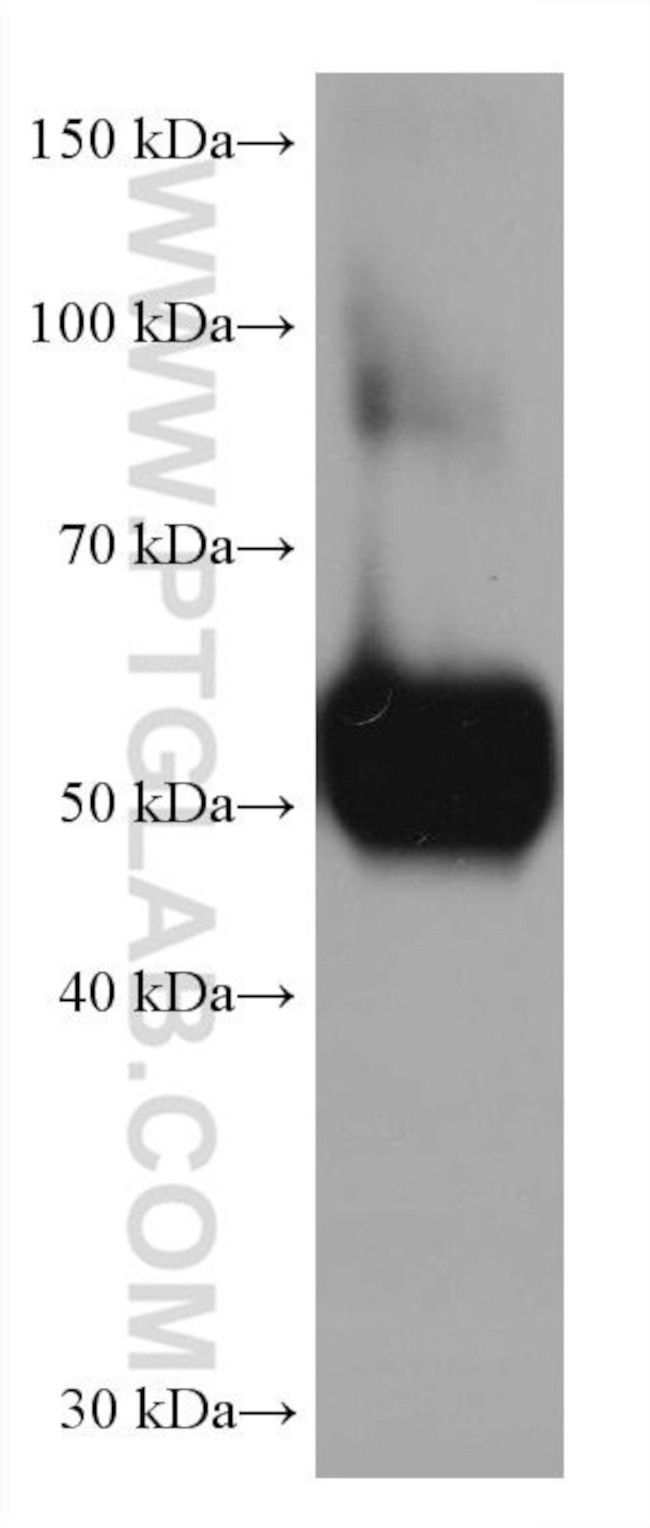 AGT Antibody in Western Blot (WB)