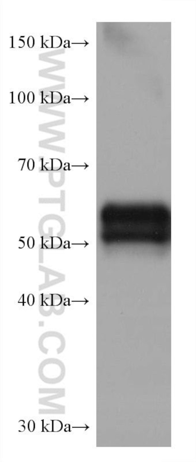 AGT Antibody in Western Blot (WB)