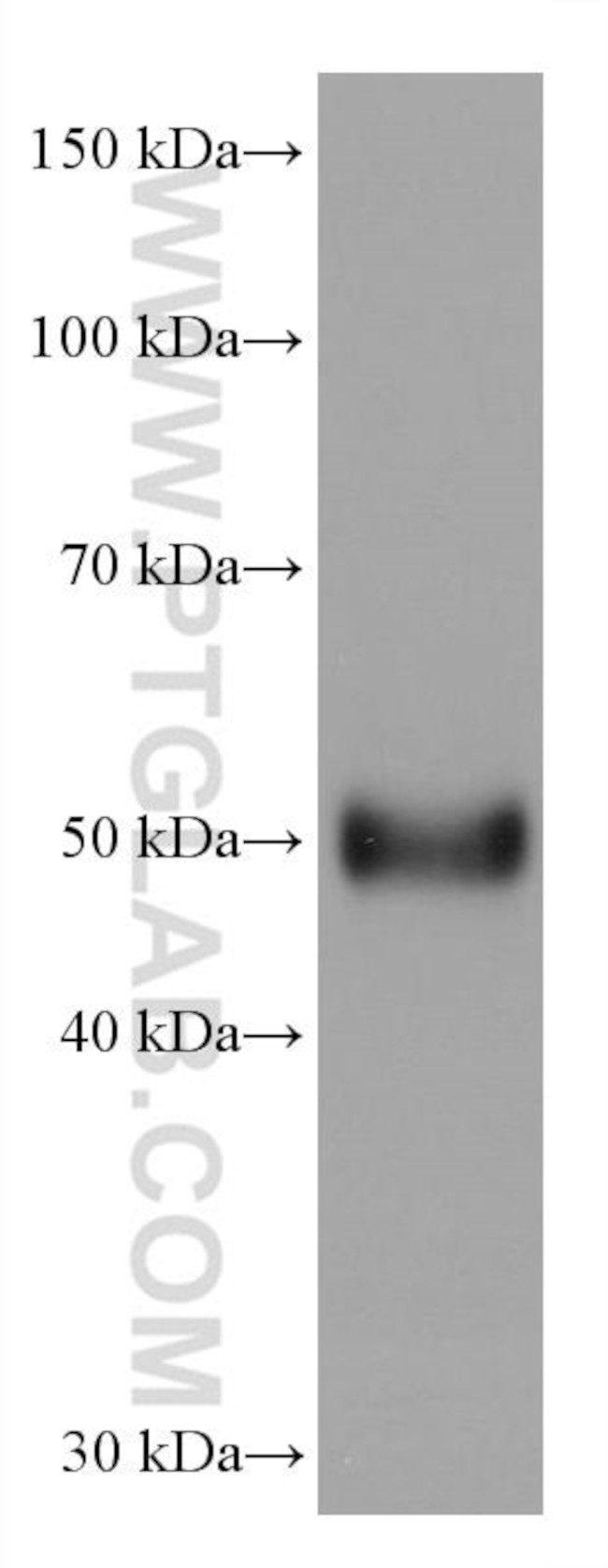 AGT Antibody in Western Blot (WB)