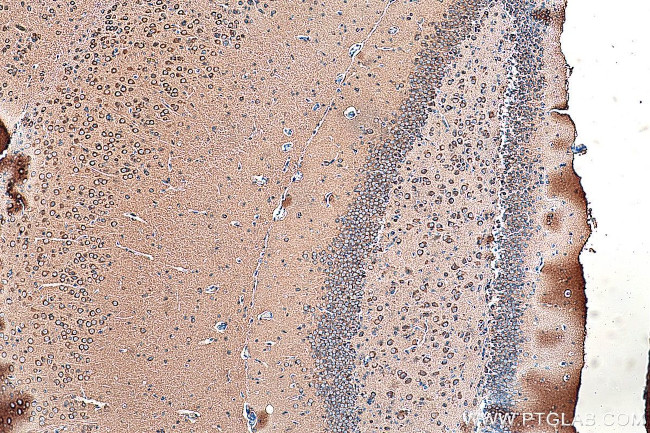 CRMP1 Antibody in Immunohistochemistry (Paraffin) (IHC (P))