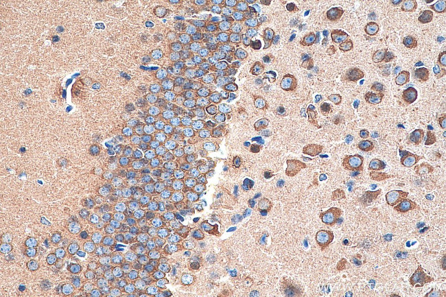 CRMP1 Antibody in Immunohistochemistry (Paraffin) (IHC (P))