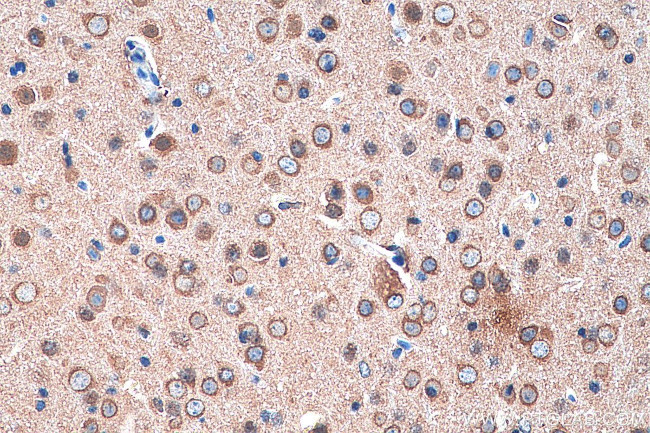 CRMP1 Antibody in Immunohistochemistry (Paraffin) (IHC (P))