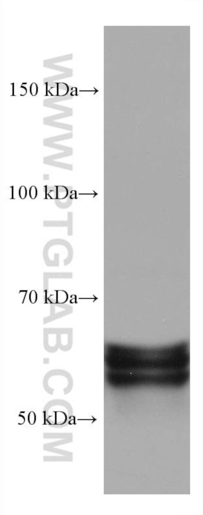 CRMP1 Antibody in Western Blot (WB)