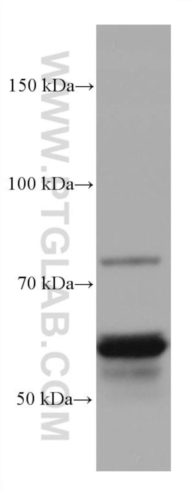 CRMP1 Antibody in Western Blot (WB)