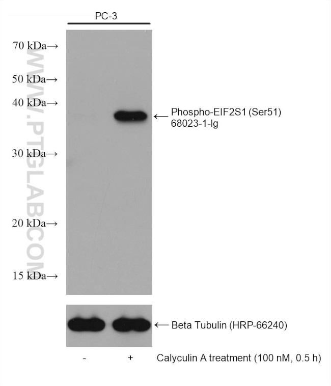 Phospho-EIF2S1 (Ser51) Antibody in Western Blot (WB)