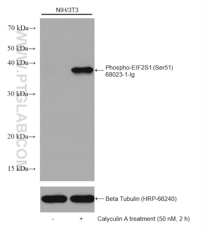 Phospho-EIF2S1 (Ser51) Antibody in Western Blot (WB)