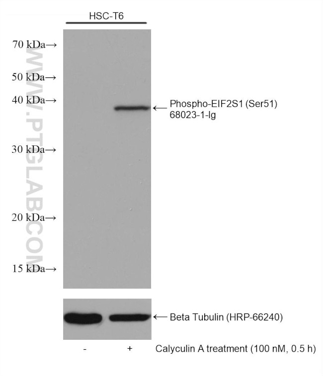 Phospho-EIF2S1 (Ser51) Antibody in Western Blot (WB)