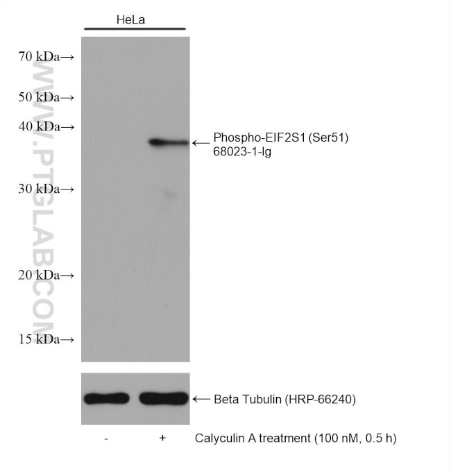 Phospho-EIF2S1 (Ser51) Antibody in Western Blot (WB)