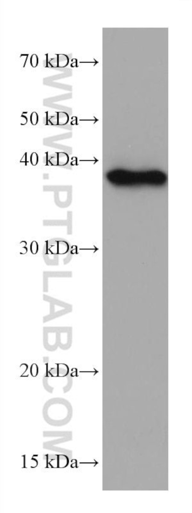 Phospho-EIF2S1 (Ser51) Antibody in Western Blot (WB)