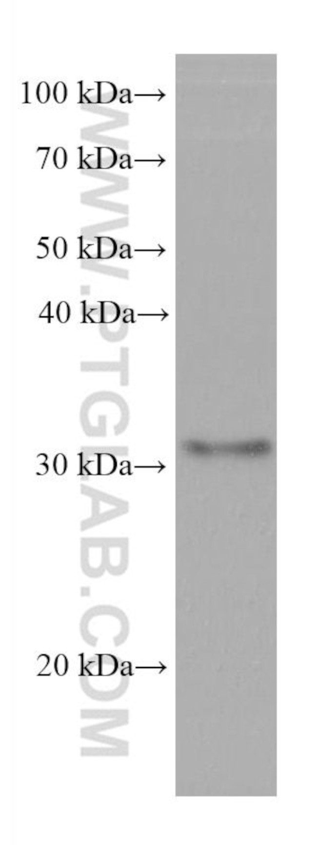 SLC39A3 Antibody in Western Blot (WB)