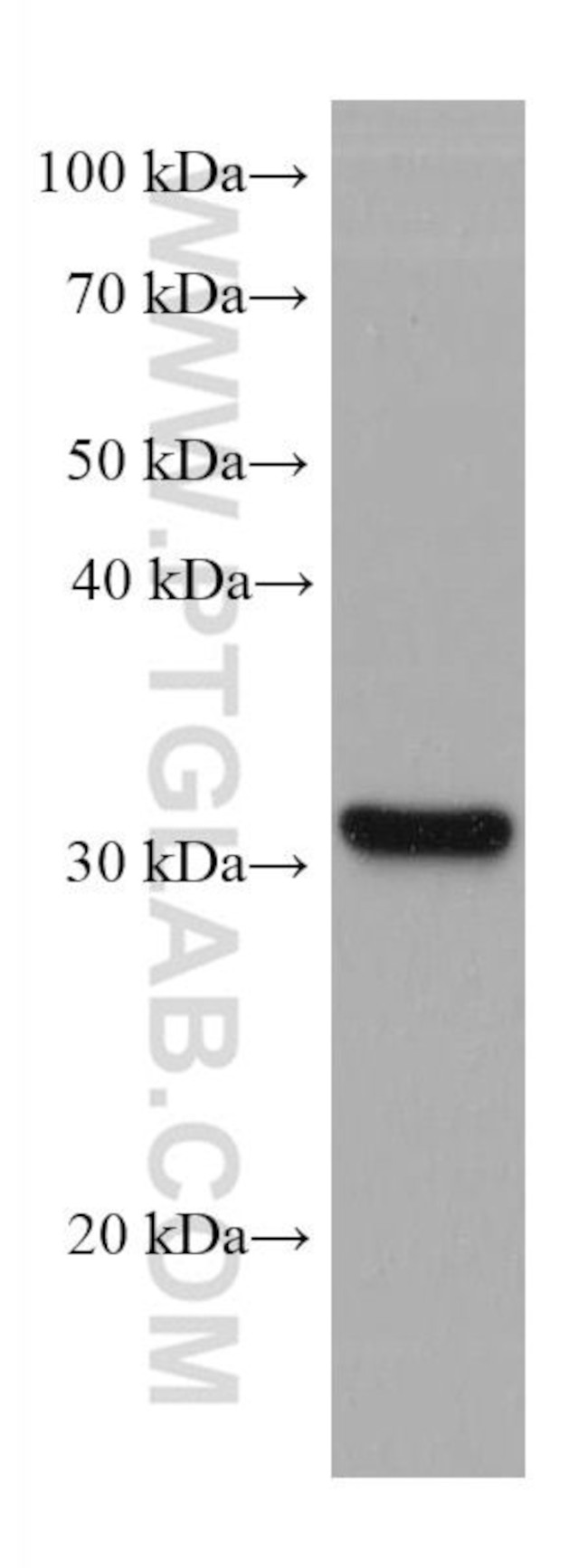 SLC39A3 Antibody in Western Blot (WB)