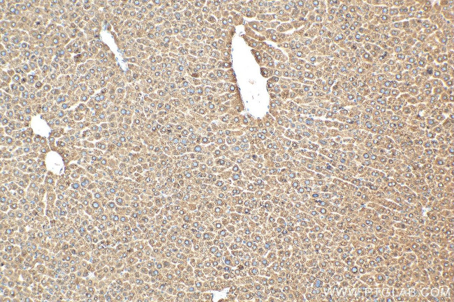 FADS2 Antibody in Immunohistochemistry (Paraffin) (IHC (P))