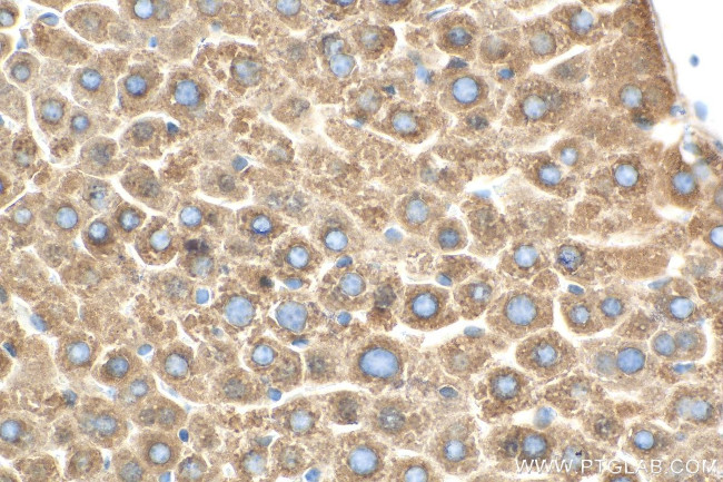 FADS2 Antibody in Immunohistochemistry (Paraffin) (IHC (P))