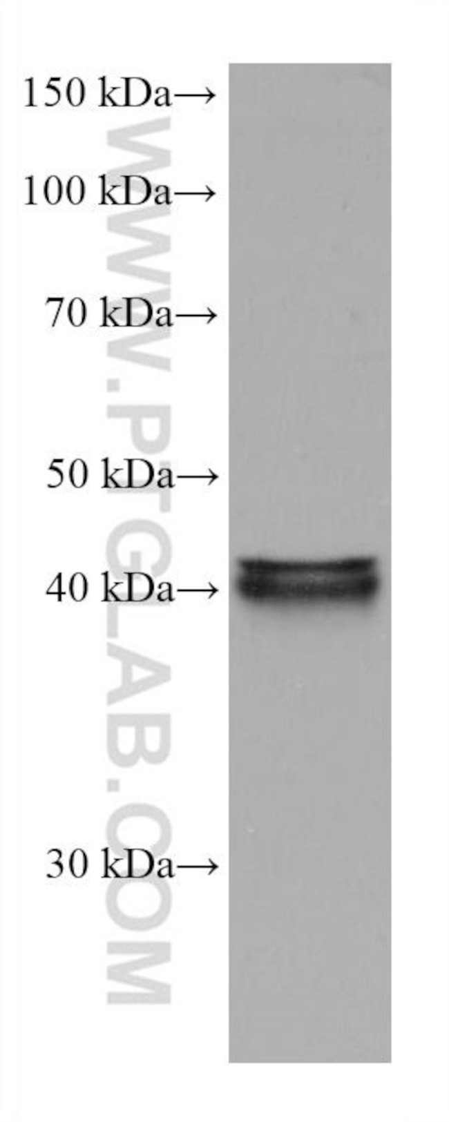 FADS2 Antibody in Western Blot (WB)