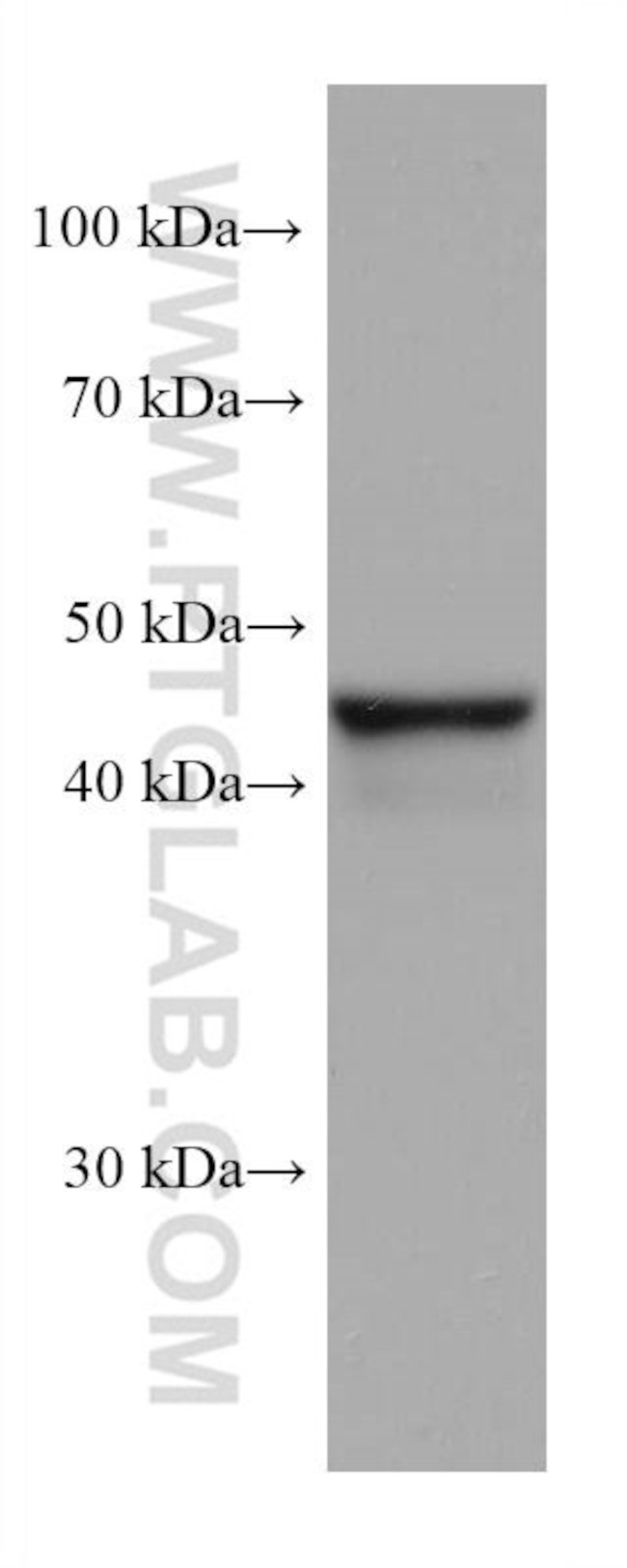 FADS2 Antibody in Western Blot (WB)