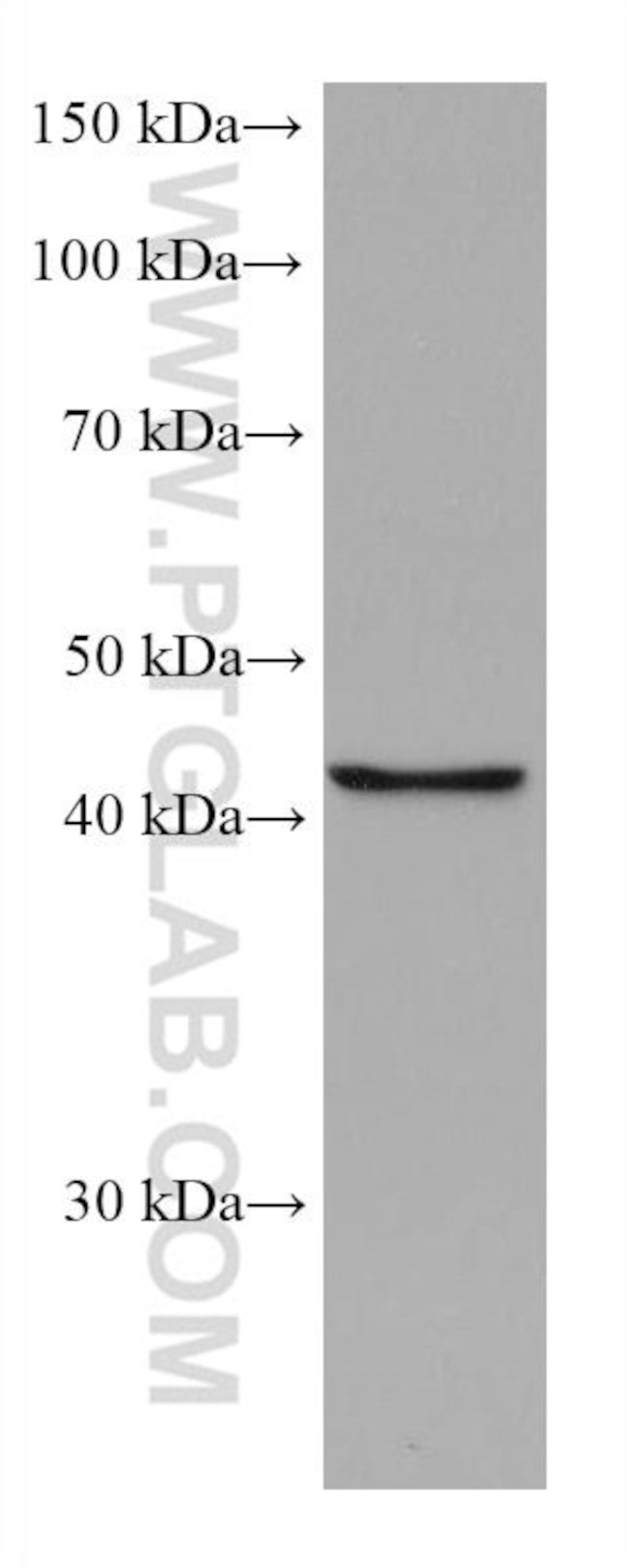 FADS2 Antibody in Western Blot (WB)