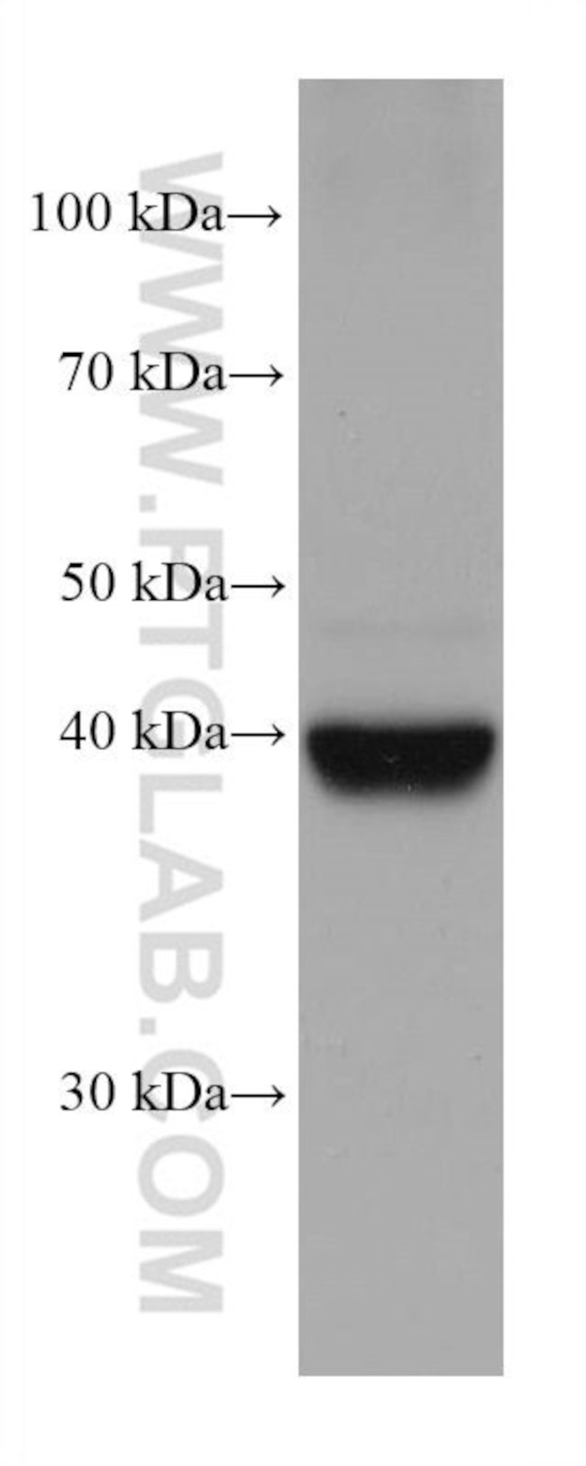 FADS2 Antibody in Western Blot (WB)