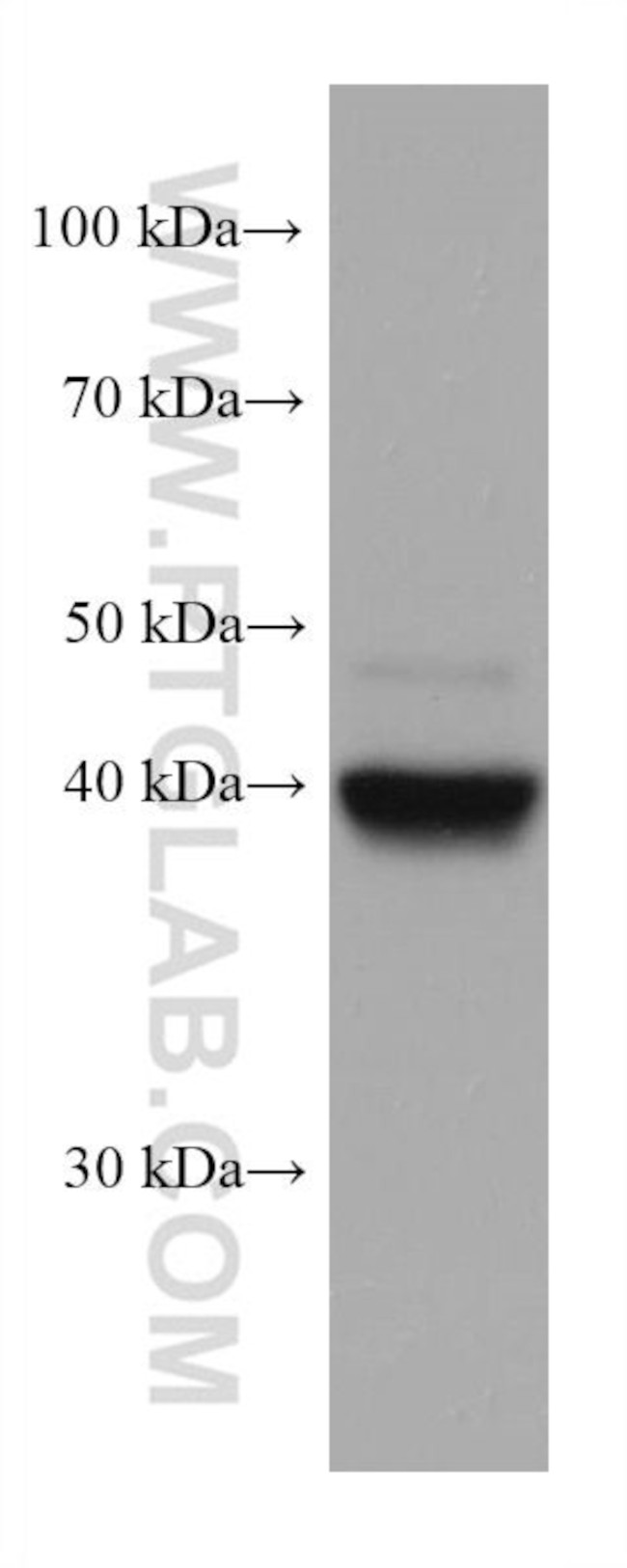 FADS2 Antibody in Western Blot (WB)