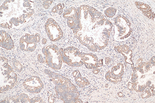 CISD1 Antibody in Immunohistochemistry (Paraffin) (IHC (P))