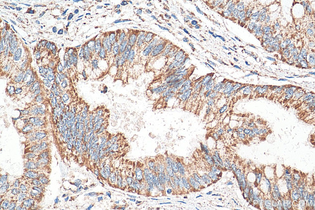 CISD1 Antibody in Immunohistochemistry (Paraffin) (IHC (P))