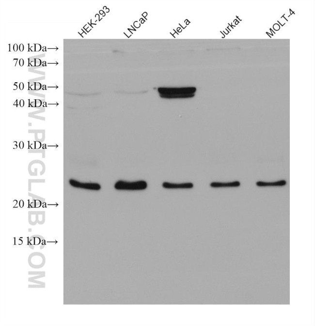 RAB9B Antibody in Western Blot (WB)