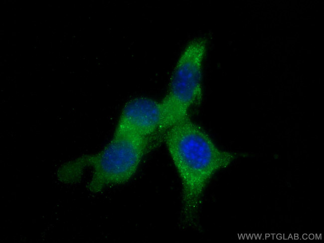 DUSP22 Antibody in Immunocytochemistry (ICC/IF)