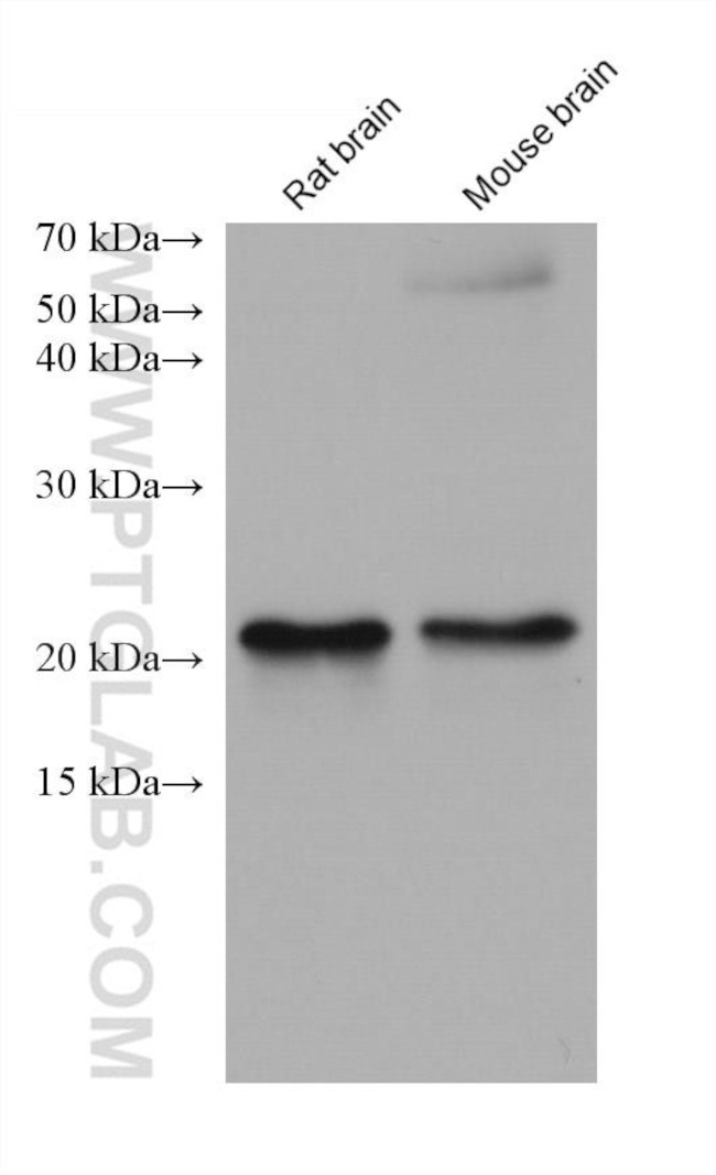 DUSP22 Antibody in Western Blot (WB)