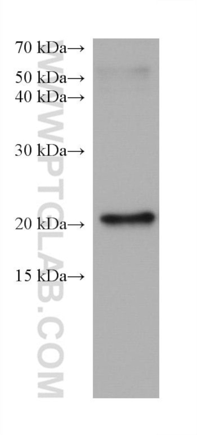 DUSP22 Antibody in Western Blot (WB)