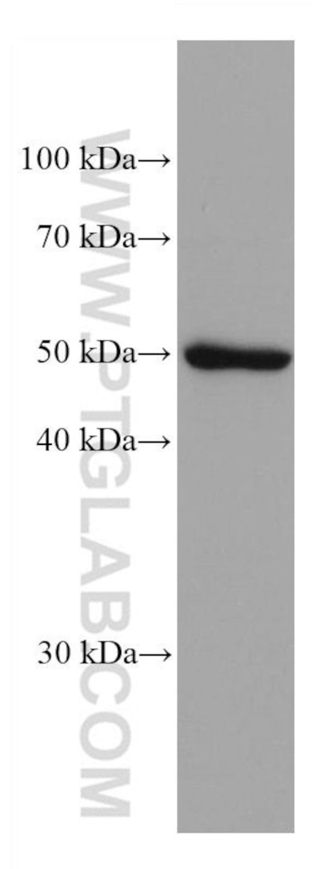 ADPGK Antibody in Western Blot (WB)