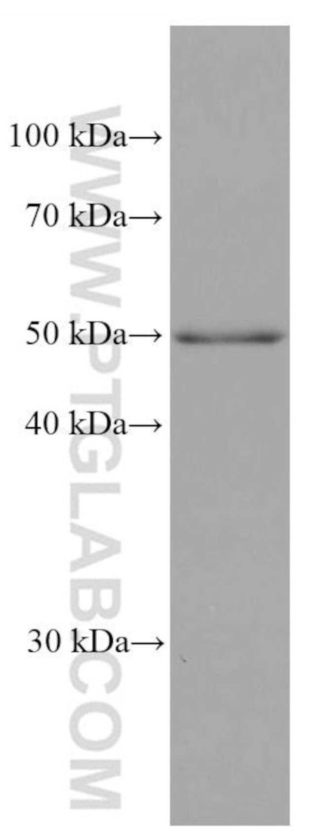 ADPGK Antibody in Western Blot (WB)