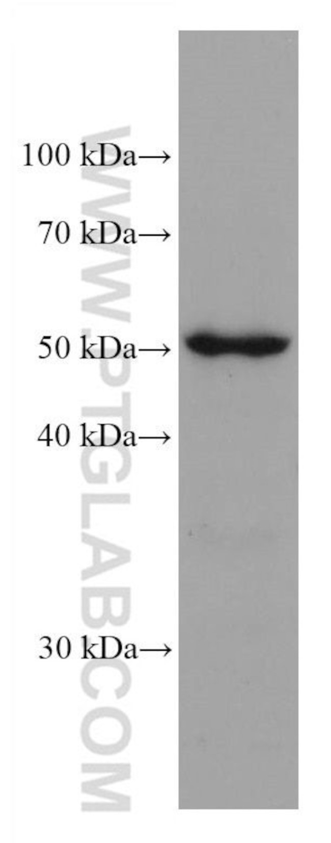 ADPGK Antibody in Western Blot (WB)