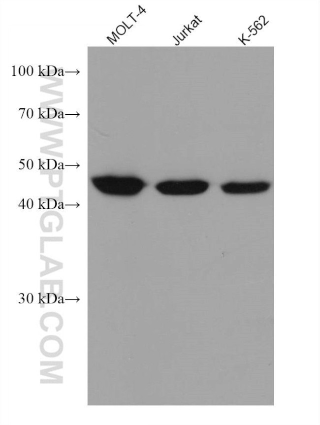 ACTR3B Antibody in Western Blot (WB)