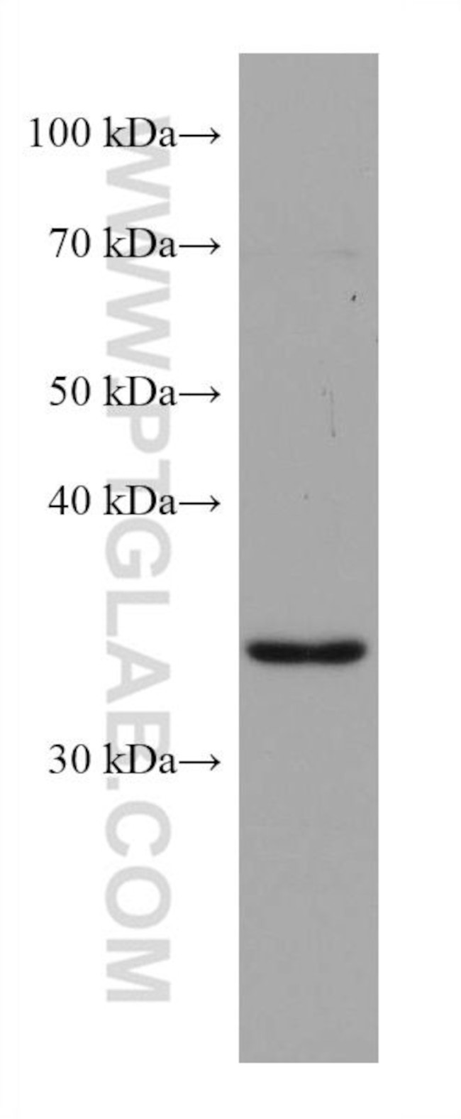 ZFP36L1 Antibody in Western Blot (WB)