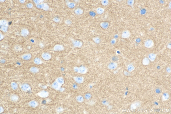 Synaptotagmin-1 Antibody in Immunohistochemistry (Paraffin) (IHC (P))