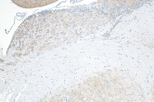 Synaptotagmin-1 Antibody in Immunohistochemistry (Paraffin) (IHC (P))