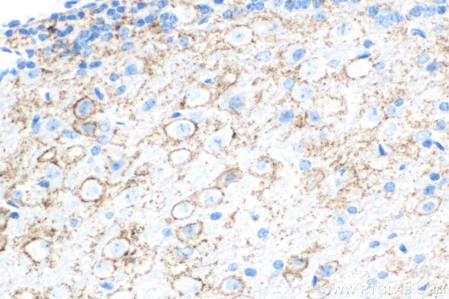 Synaptotagmin-1 Antibody in Immunohistochemistry (Paraffin) (IHC (P))