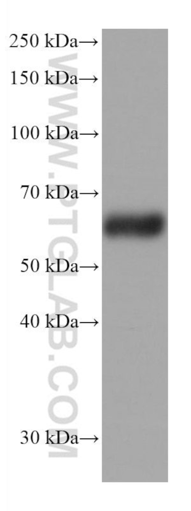 Synaptotagmin-1 Antibody in Western Blot (WB)