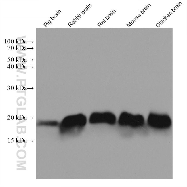 SNCB Antibody in Western Blot (WB)