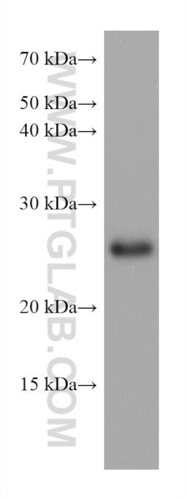 TPPP Antibody in Western Blot (WB)